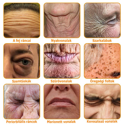 👨‍🔬 AllyBee® Botox Bőrápoló Krém Ránctalanítás, Hidratálás, Bőrregenerálás, Egyenletes Bőrtónus, Pattanás- és Sötétfolt Kezelés, Szemölcs- és Anyajegyek Eltávolítása