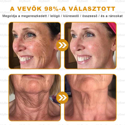 👨‍🔬 AllyBee® Botox Bőrápoló Krém Ránctalanítás, Hidratálás, Bőrregenerálás, Egyenletes Bőrtónus, Pattanás- és Sötétfolt Kezelés, Szemölcs- és Anyajegyek Eltávolítása