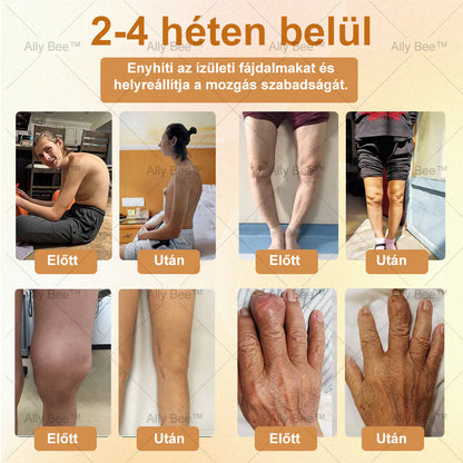 Utolsó 10 doboz! 🎁 Kapjon exkluzív 30% kedvezményt és élénkítse ízületeit csak 2-3 héten belül! Ne hagyja ki ezt a lehetőséget—ez nem fog visszatérni a következő évig! Élvezze 180 napos pénzvisszafizetési garanciánkat!